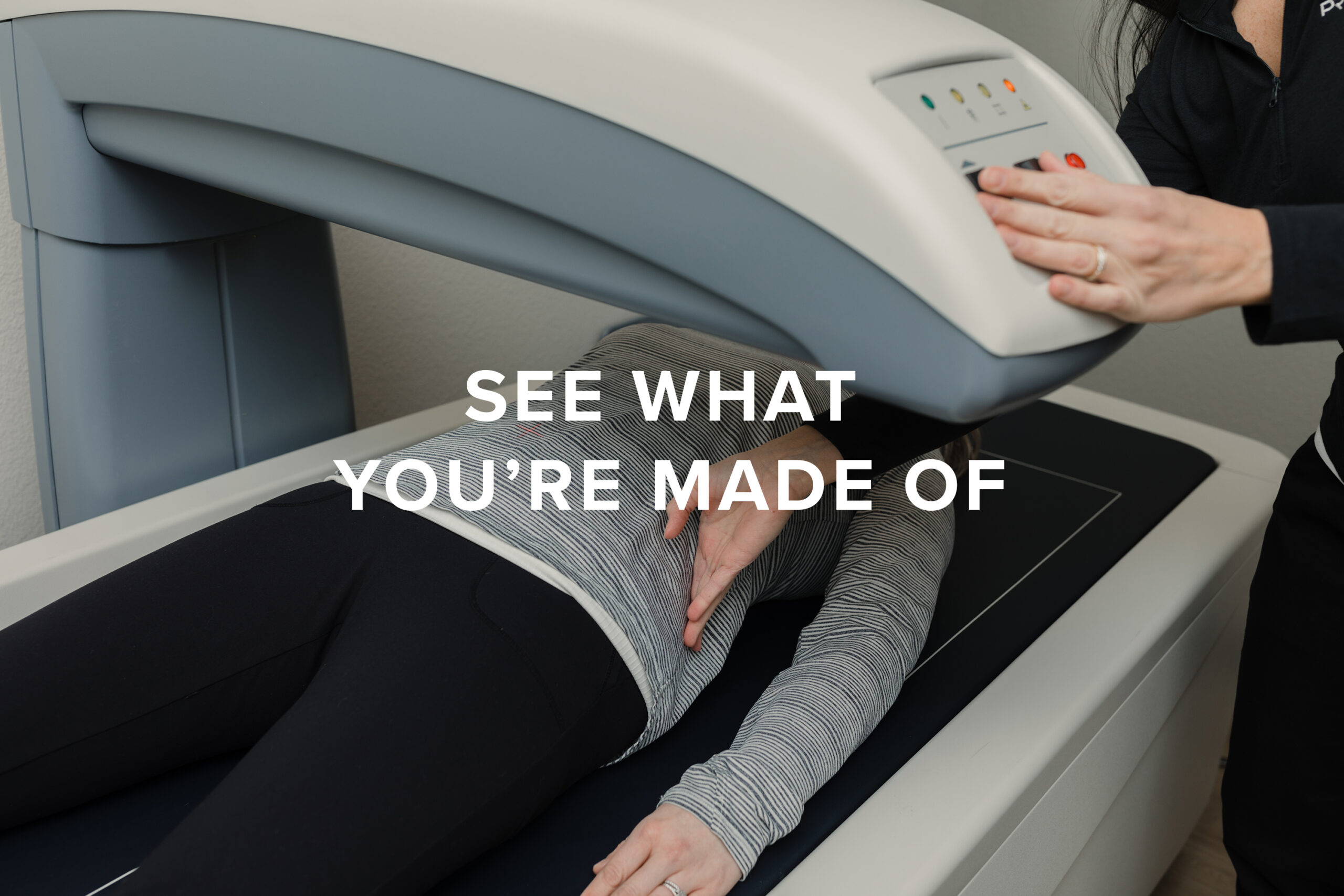 DEXA Scan: What It Is and Why It's Done
